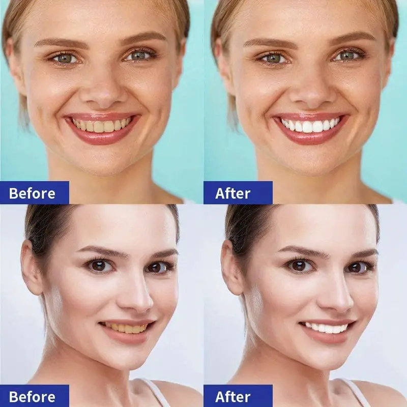3 boxes SPECIAL PRICE - Teeth Whitening Strips 7 treatments 5D or 9D. - Image 7